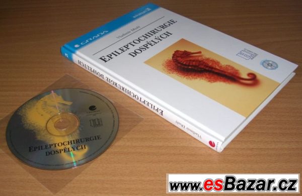 EPILEPTOCHIRURGIE DOSPĚLÝCH – fotografie 4