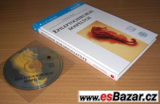 EPILEPTOCHIRURGIE DOSPĚLÝCH – fotografie 4